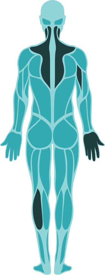 Illustration of the human body with muscle groups highlighted